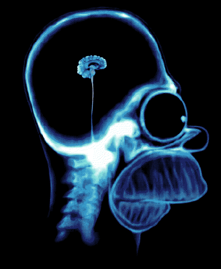 accurate brain scan