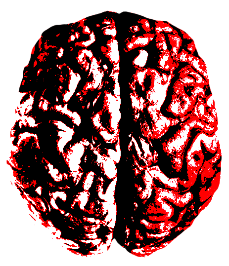 Cerebro