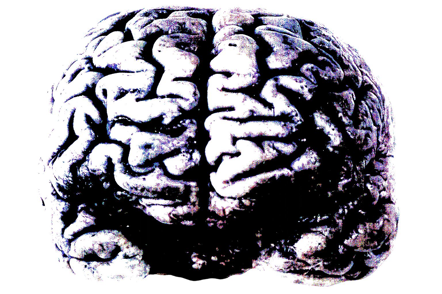 Cerebro